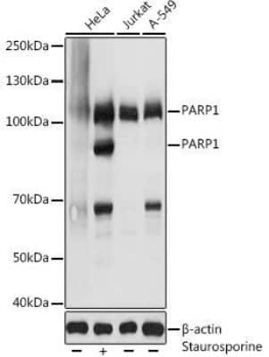 Western Blot: PARP AntibodyAzide and BSA Free [NBP3-03817]