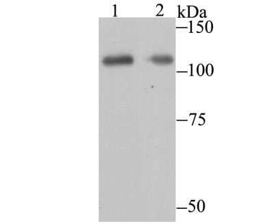 Western Blot: PARP Antibody [NBP3-09070]