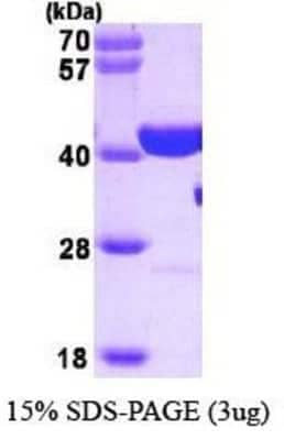 SDS-PAGE: Recombinant Human PARP Protein [NBP1-37088]