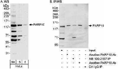 Western Blot: PARP10 Antibody [NB100-2157]