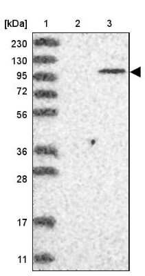 Western Blot: PARP10 Antibody [NBP1-83689]