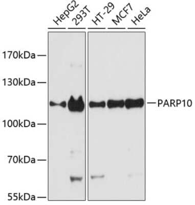 Western Blot: PARP10 AntibodyAzide and BSA Free [NBP2-93286]