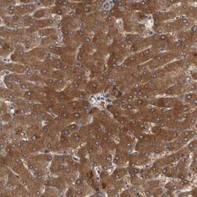 Immunohistochemistry-Paraffin: PARP11 Antibody [NBP1-88394]