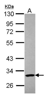 Western Blot: PARP11 Antibody [NBP2-19699]