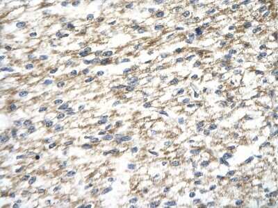 Immunohistochemistry: PARP12 Antibody [NBP1-56436]