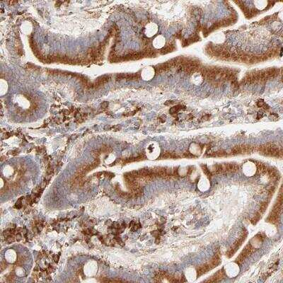 Immunohistochemistry-Paraffin: PARP12 Antibody [NBP1-83592]