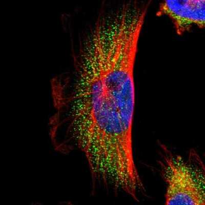 Immunocytochemistry/ Immunofluorescence: PARP14 Antibody [NBP1-93593]