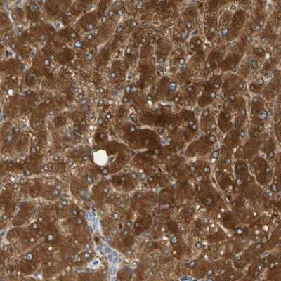 Immunohistochemistry-Paraffin: PARP14 Antibody [NBP1-93592]