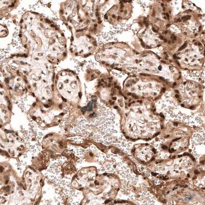 Immunohistochemistry-Paraffin: PARP14 Antibody [NBP1-93593]