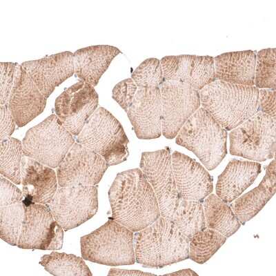 Immunohistochemistry-Paraffin: PARP14 Antibody [NBP1-93593]