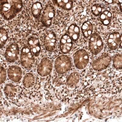 Immunohistochemistry-Paraffin: PARP14 Antibody [NBP1-93593]