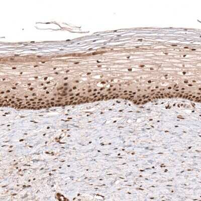 Immunohistochemistry-Paraffin: PARP14 Antibody [NBP1-93593]