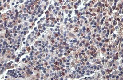 Immunohistochemistry-Paraffin: PARP14 Antibody [NBP3-13051]