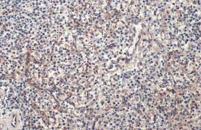 Immunohistochemistry-Paraffin: PARP14 Antibody [NBP3-13051]