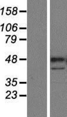 Western Blot: PARP15 Overexpression Lysate [NBP2-05330]