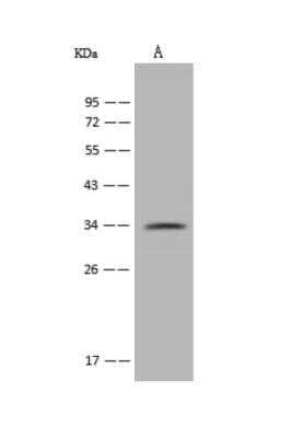 Western Blot: PARP16 Antibody [NBP3-06231]