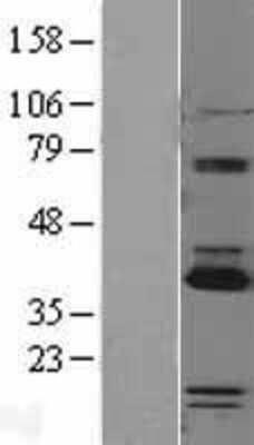 Western Blot: PARP16 Overexpression Lysate [NBL1-14114]