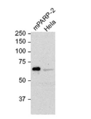 Western Blot: PARP2 Antibody (4G8) [NBP2-89041]