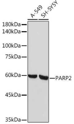 Western Blot: PARP2 Antibody (6G5U7) [NBP3-16618]