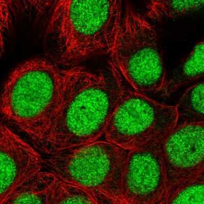 Immunocytochemistry/ Immunofluorescence: PARP2 Antibody [NBP2-47337]