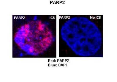 Immunocytochemistry/ Immunofluorescence: PARP2 Antibody [NBP1-54680]