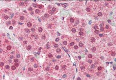 Immunohistochemistry-Paraffin: PARP2 Antibody [NB100-2556]