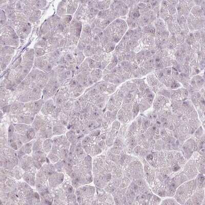 Immunohistochemistry-Paraffin: PARP2 Antibody [NBP2-47337]