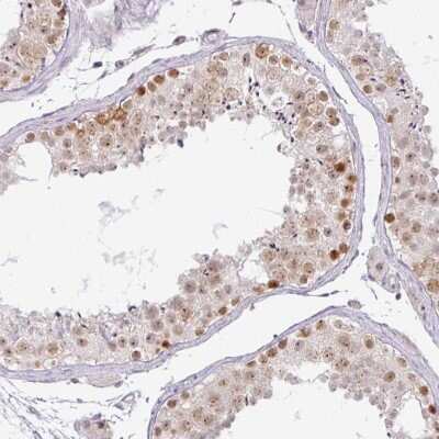 Immunohistochemistry-Paraffin: PARP2 Antibody [NBP2-47337]