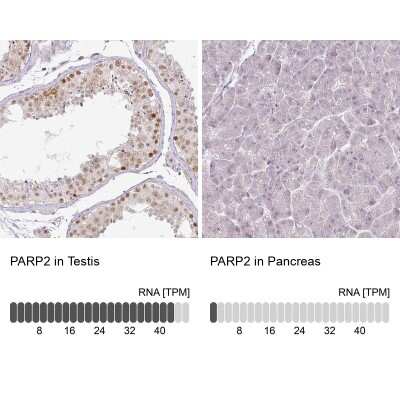 Immunohistochemistry-Paraffin: PARP2 Antibody [NBP2-47337]