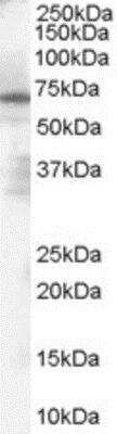 Western Blot: PARP2 Antibody [NB100-2556]