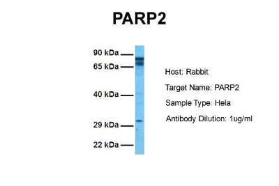 Western Blot: PARP2 Antibody [NBP1-54680]