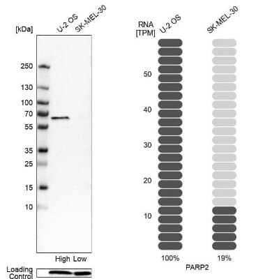 Western Blot: PARP2 Antibody [NBP2-47337]