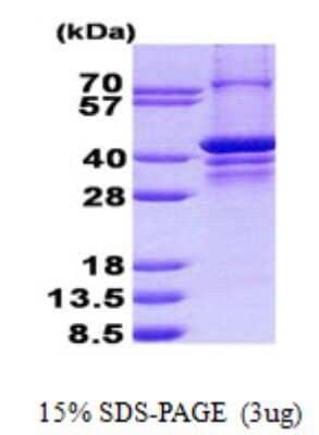 SDS-PAGE: Recombinant Human PARP2 His Protein [NBP2-23339]