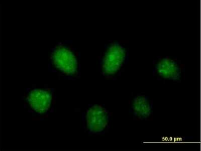 Immunocytochemistry/ Immunofluorescence: PARP3 Antibody [H00010039-B01P]