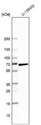 Western Blot: PARP3 Antibody [NBP2-49523]