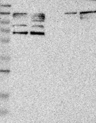 Western Blot: PARP3 Antibody [NBP3-17288]