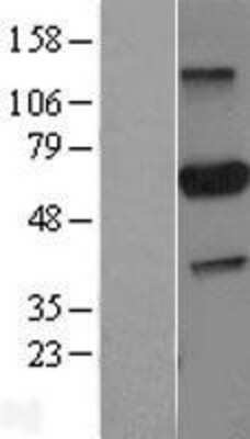 Western Blot: PARP3 Overexpression Lysate [NBL1-14116]