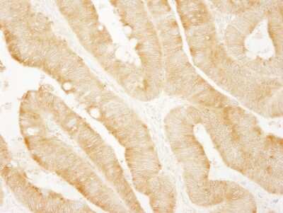 Immunohistochemistry-Paraffin: PARP4 Antibody [NBP1-06563]