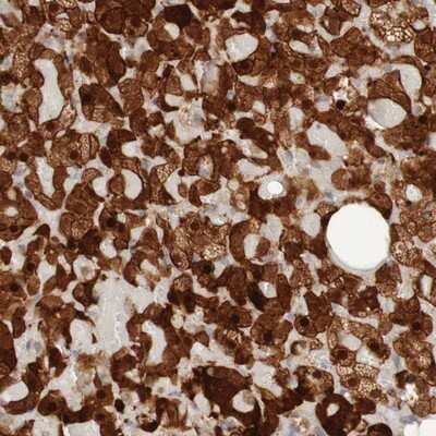 Immunohistochemistry-Paraffin: PARP4 Antibody [NBP1-89232]