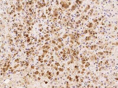 Immunohistochemistry-Paraffin: PARP4 Antibody [NBP2-97710]