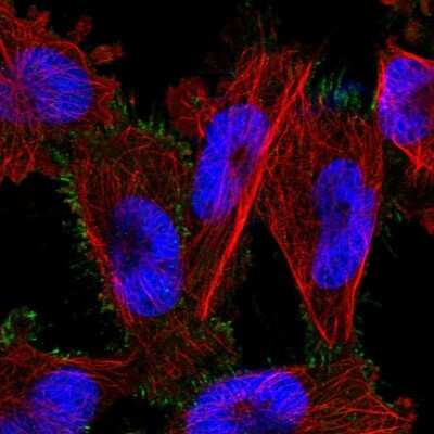 Immunocytochemistry/ Immunofluorescence: PARP6 Antibody [NBP1-87333]