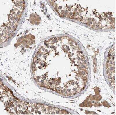 Immunohistochemistry-Paraffin: PARP6 Antibody [NBP1-87333]