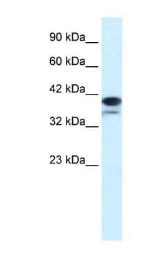 Western Blot: PARP6 Antibody [NBP1-52950]