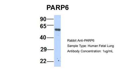 Western Blot: PARP6 Antibody [NBP2-85443]