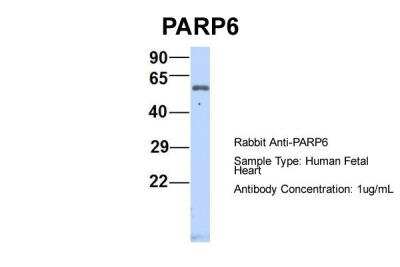 Western Blot: PARP6 Antibody [NBP2-85443]
