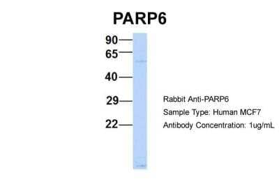 Western Blot: PARP6 Antibody [NBP2-85443]