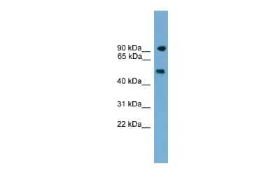 Western Blot: PARP8 Antibody [NBP2-83360]