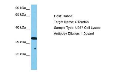 Western Blot: PARPBP Antibody [NBP2-83363]