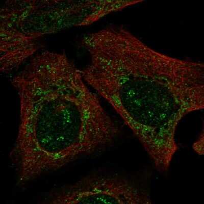 Immunocytochemistry/ Immunofluorescence: PARS2 Antibody [NBP2-54971]