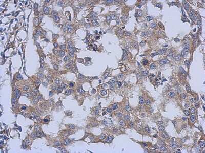 Immunohistochemistry-Paraffin: PARS2 Antibody [NBP2-19702]